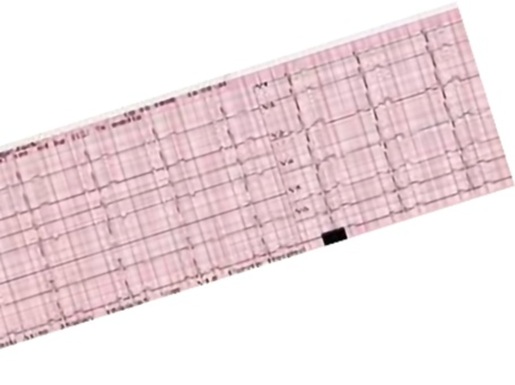 ECG8031-1_wmsie.jpg